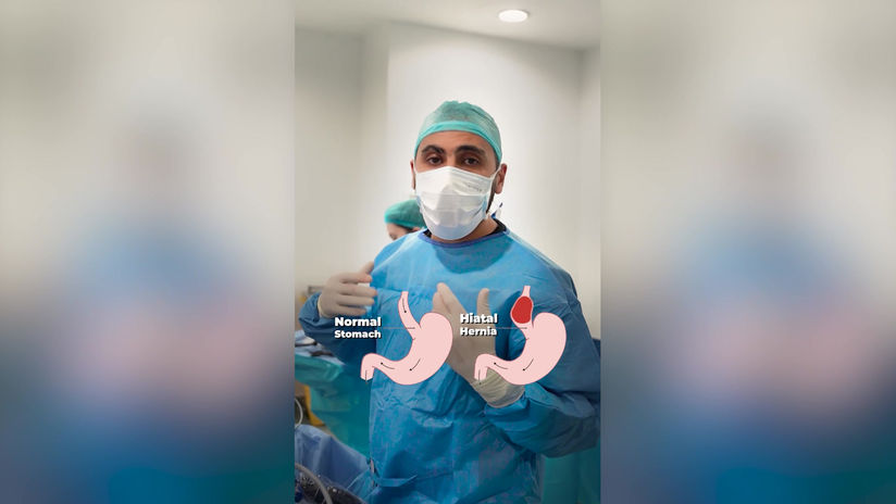 Hiatal Hernia